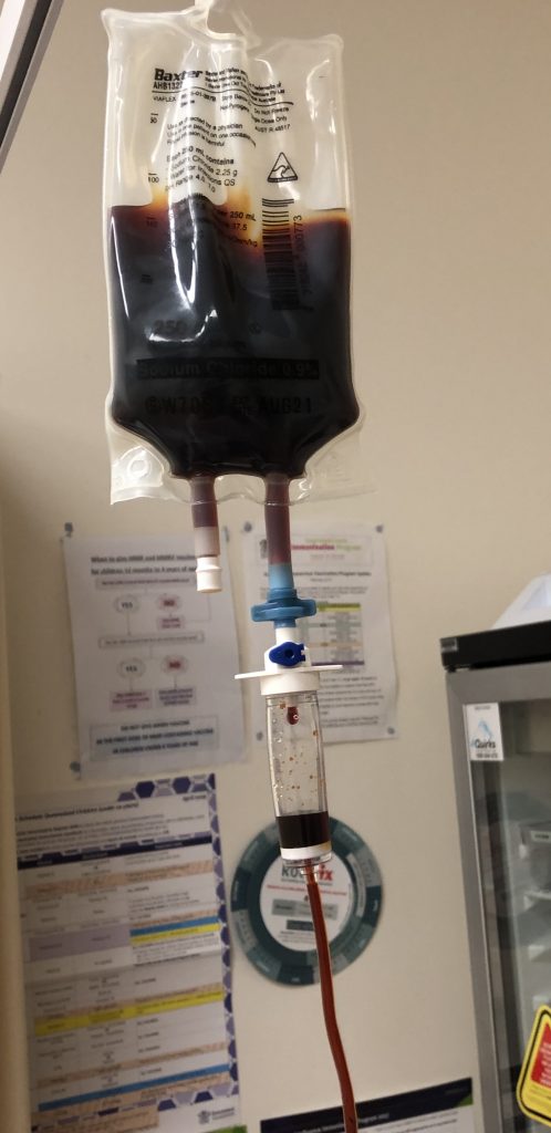 iron-infusion-low-iron-ferinject-mudgeeraba-iron-infusion-iron